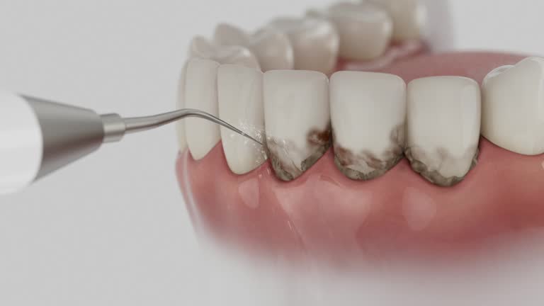 Trusted Teeth Cleaning And Checkup service in Mount Repose, OH - Dentist Open Now